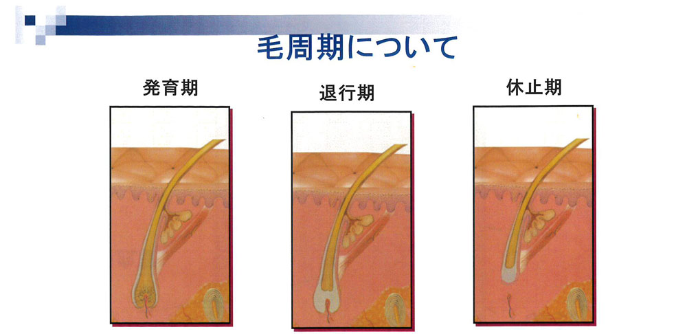 池袋セントラルクリニック｜医療レーザー脱毛・完全マニュアル　毛周期について