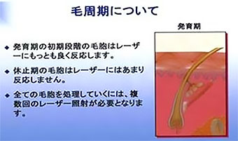 池袋セントラルクリニック|医療レーザー脱毛・完全マニュアル