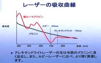 池袋セントラルクリニック|医療レーザー脱毛・完全マニュアル