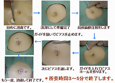 池袋東口徒歩3分｜池袋セントラルクリニック｜ヘソピアス